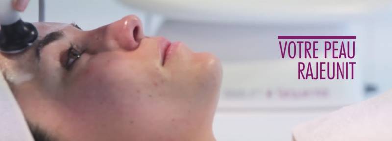 Radiofréquence chez Nail Styl Sylwia 