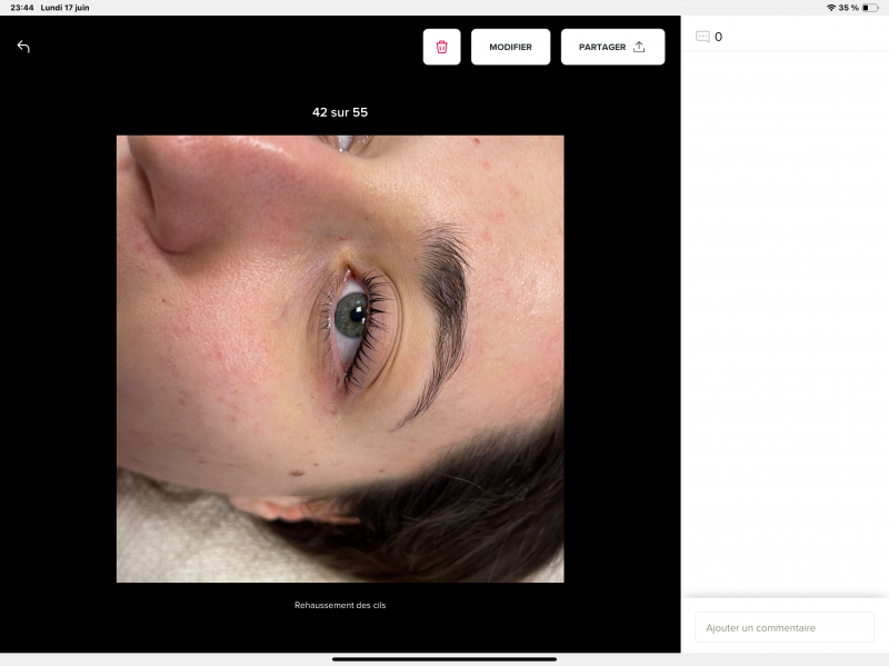 REHAUSSEMENT DE CILS