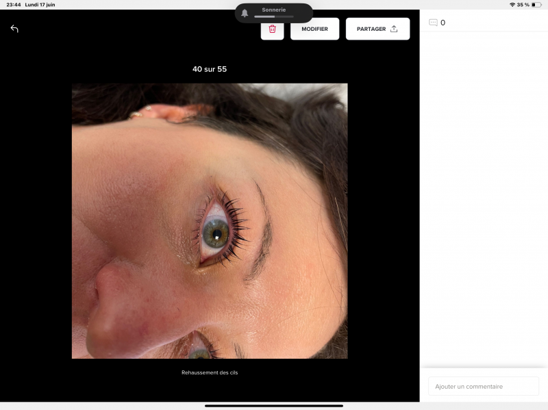 REHAUSSEMENT DE CILS