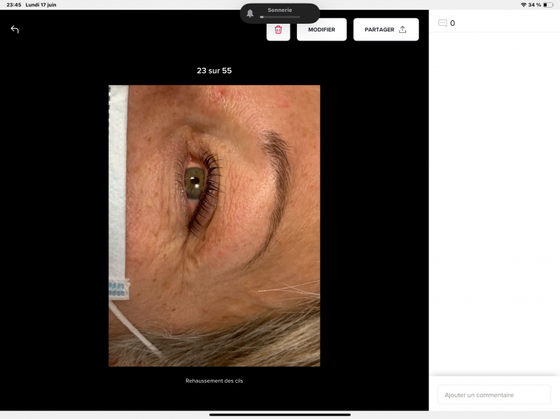 REHAUSSEMENT DE CILS