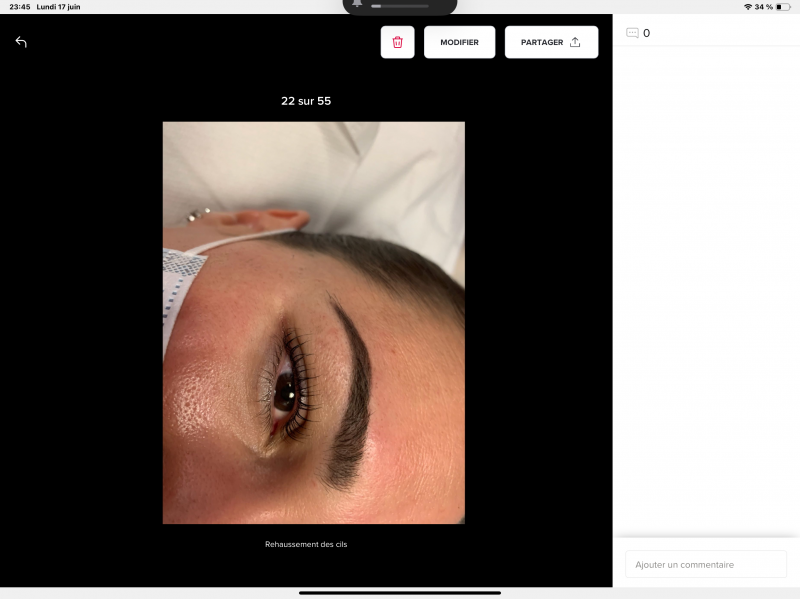 REHAUSSEMENT DE CILS